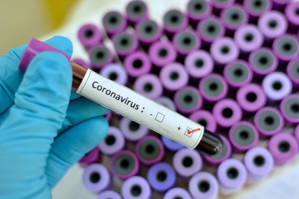 Названы три первых признака коронавируса